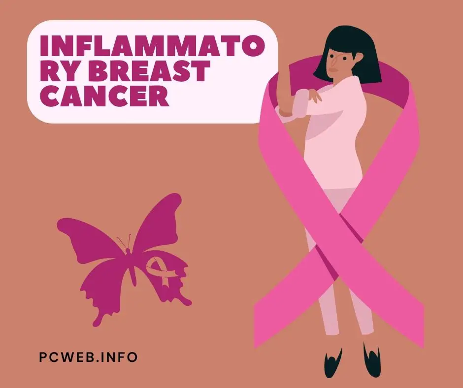 Inflammatory breast cancer: symptoms, prognosis, survival rate, treatment