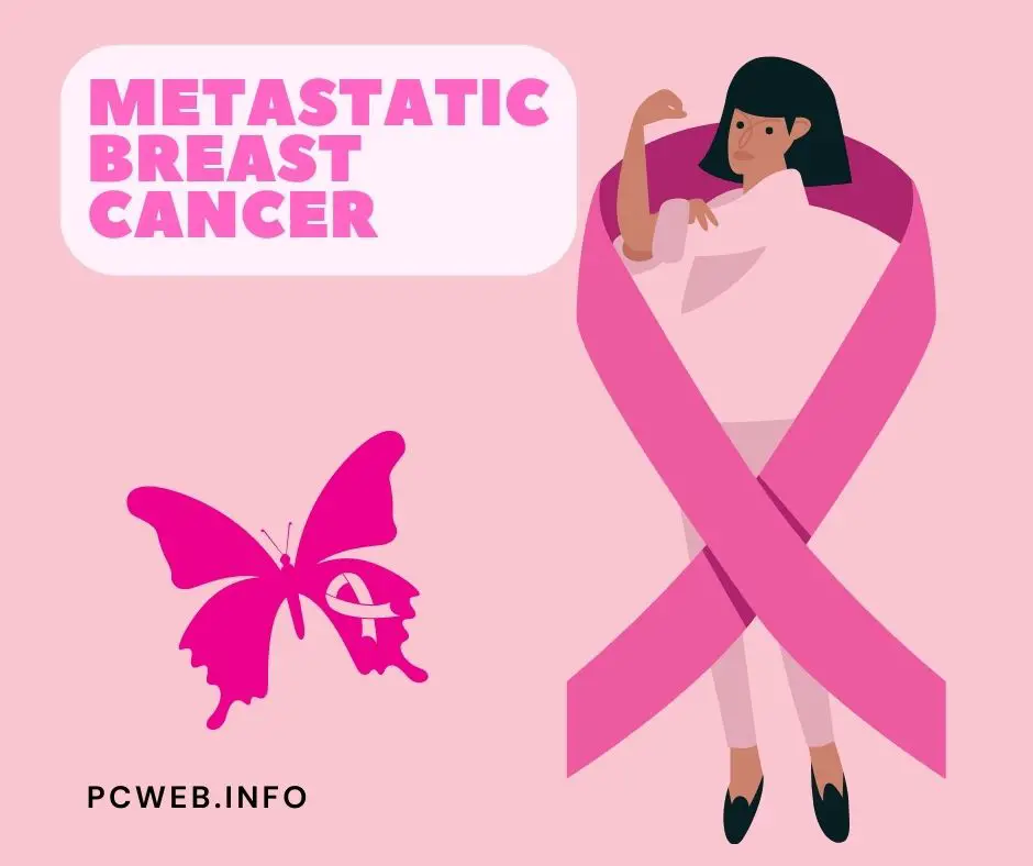 Metastatic breast cancer: symptoms, survival rate, treatment, in bones, ribbon